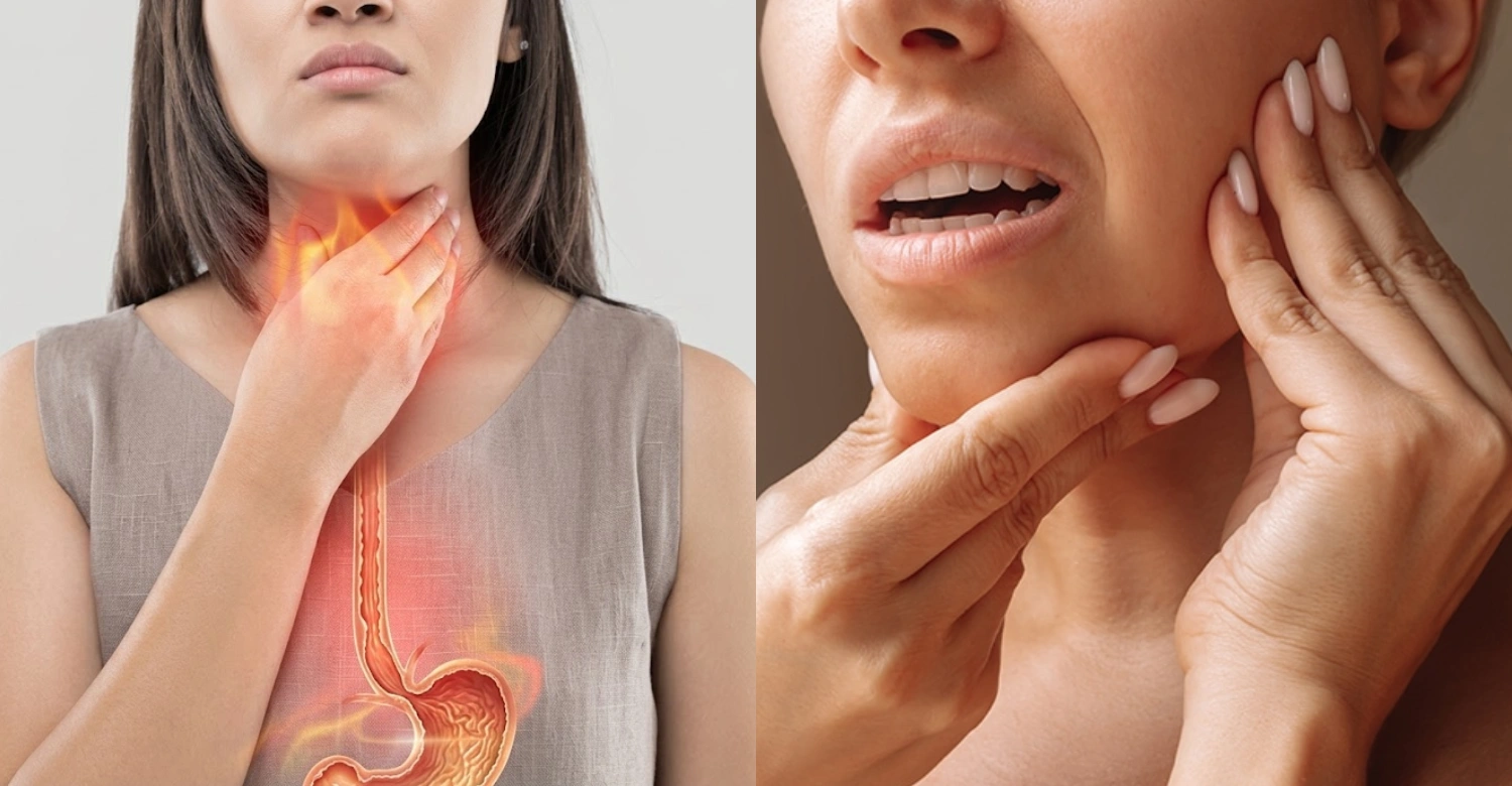 Heartburn and Jaw Pain inblog